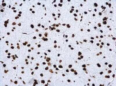 Immunohistochemistry-Paraffin: Histone H4 [Trimethyl Lys20] Antibody [NBP2-42862]